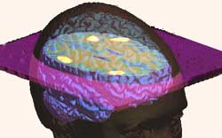Größe des Gehirns